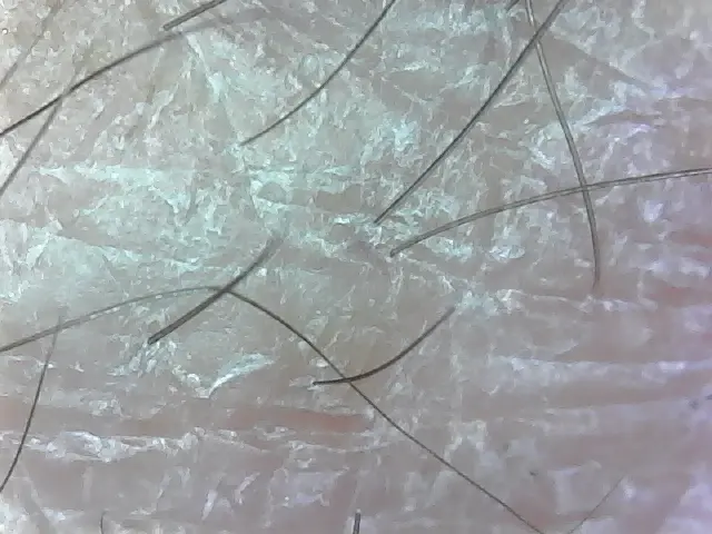 Pluggable USB microscope review 14 Hairs on my hand
